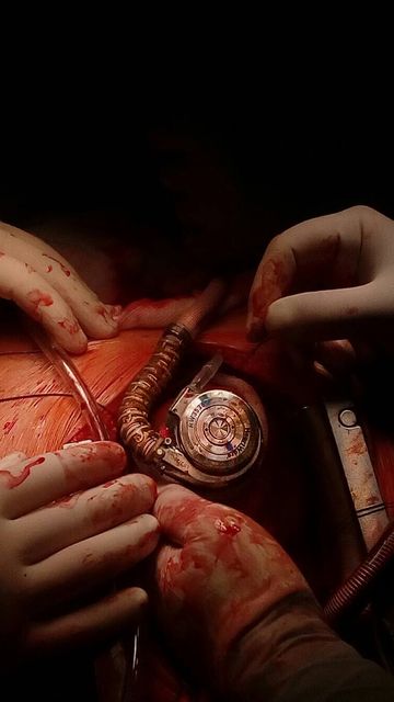 Mechanical Hearth Saving Life